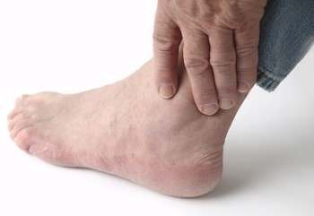 Gout Relief