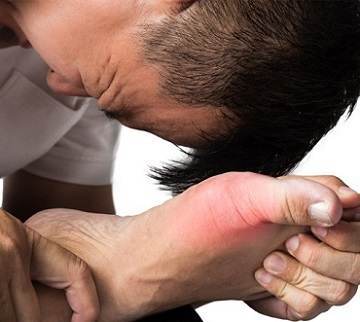  Gout Prevention